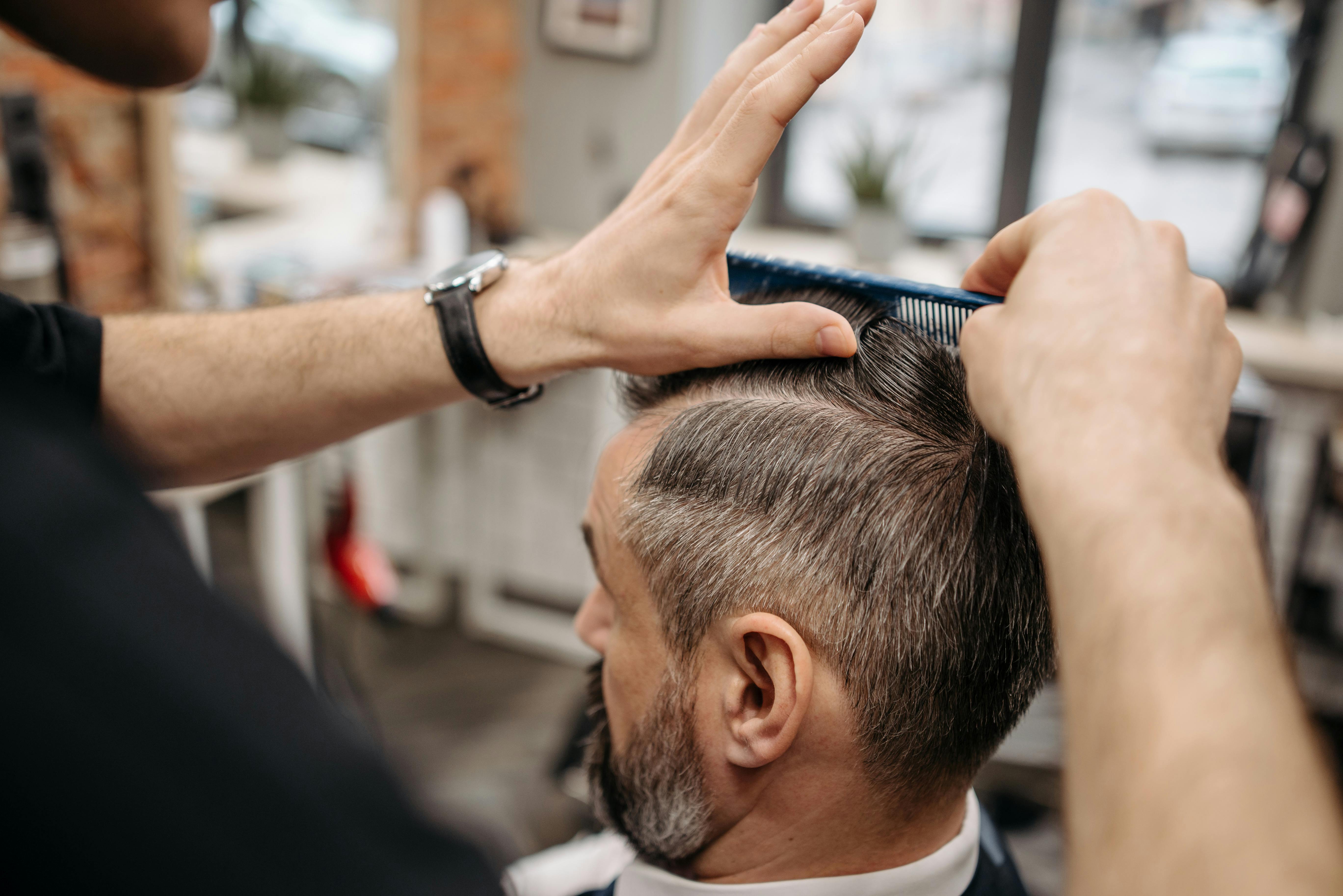 DHI Hair Transplant in Albania: A Guide to the Choi Implanter Pen